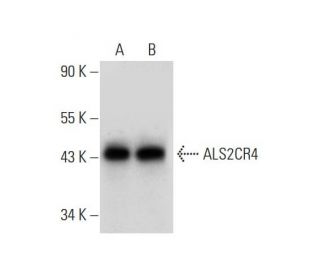 ALS2CR4 Antibody (C-6) - Western Blotting - Image 323846