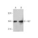 ALY Antibody (4i214) - Western Blotting - Image 377249