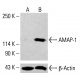 AMAP-1(E-5)抗体:sc-377495。通过蛋白质印迹分析未处理(A)和化学处理(B)的HCT-116完整细胞裂解物中的AMAP-1表达。β-肌动蛋白(C4):sc-47778用作加载对照。使用的检测试剂:m-IgG Fc BP-HRP:sc-525409。  AMAP-1 Antibody (E-5) - Western Blotting - Image 414965