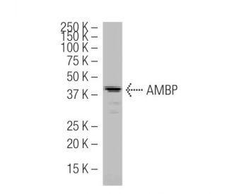 AMBP Antibody (532) - Western Blotting - Image 33598 