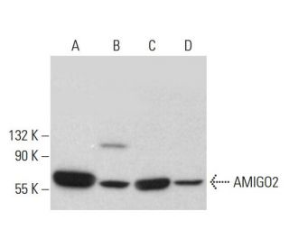 AMIGO2 Antibody (G-7) - Western Blotting - Image 383917 