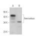 Amnionless Antibody (F-7) - Western Blotting - Image 366037