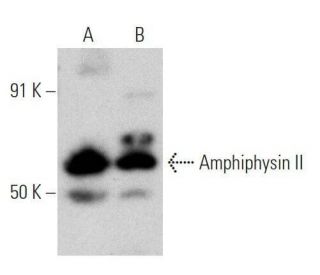 Amphiphysin II Antibody (99D) - Western Blotting - Image 356305 