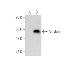 Amylase Antibody (A-1) - Western Blotting - Image 316266 