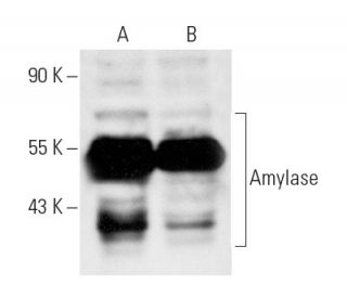 Amylase Antibody (G-10) - Western Blotting - Image 10422 