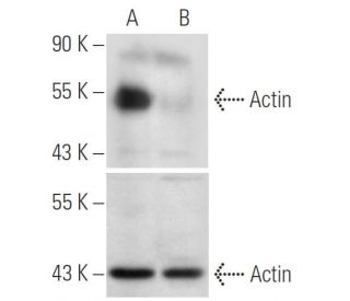 Amylase shRNA Plasmid (h): sc-29675-SH. Western blot analysis of human Amylase expression in Amylase transfected (A) and A 