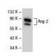 Angiopoietin 2/Ang-2/ANGPT2 Antibody (H-11) - Western Blotting - Image 45763 