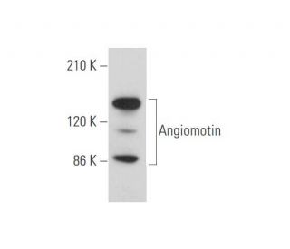 Angiomotin Antibody (G-12) - Western Blotting - Image 344619