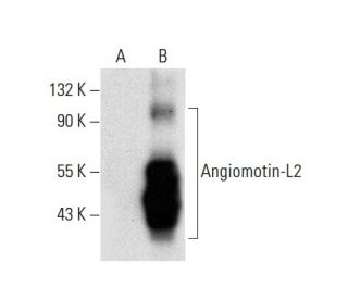 Angiomotin-L2 Antibody (A-9) - Western Blotting - Image 303494