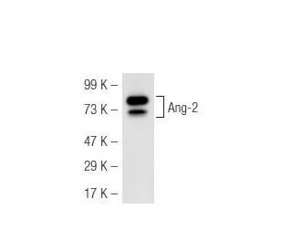 Angiopoietin 2/Ang-2/ANGPT2 Antibody (H-11) - Western Blotting - Image 45760