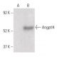 Angptl4 Antibody (A-2) - Western Blotting - Image 400404
