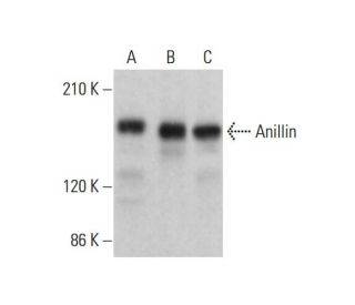 Anillin Antibody (B-10) - Western Blotting - Image 382601 