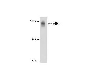 ANK-1 Antibody (8G6) - Western Blotting - Image 18177