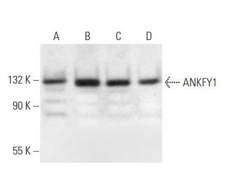 ANKFY1 Antibody (B-6) - Western Blotting - Image 294791SAM Transcription Activation: SAM system utilizing dCas9-VP64, MS2-P65-HSF1, and sgRNA for precise gene transcription activation.