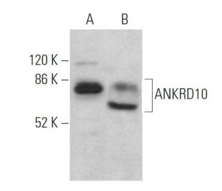 ANKRD10 Antibody (G-5) - Western Blotting - Image 369034 