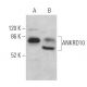 ANKRD10 Antibody (G-5) - Western Blotting - Image 369034 