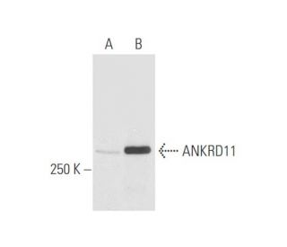 ANKRD11 Antibody (2022C8a) - Western Blotting - Image 56983 