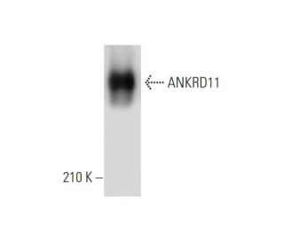 ANKRD11 Antibody (E-4) - Western Blotting - Image 333589