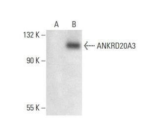 ANKRD20A Antibody (B-9) - Western Blotting - Image 300411