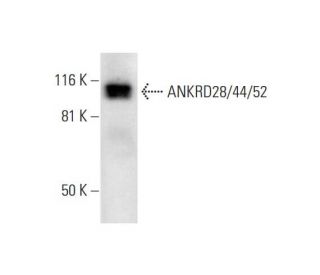 ANKRD28/44/52 Antibody (G-6) - Western Blotting - Image 291958 