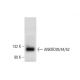 ANKRD28/44/52 Antibody (G-6) - Western Blotting - Image 305757