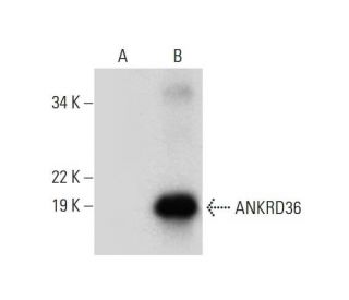 ANKRD36 Antibody (E-4) - Western Blotting - Image 297973