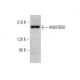 ANKRD50 Antibody (B-11) - Western Blotting - Image 346534
