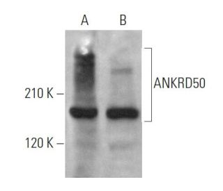 ANKRD50 Antibody (B-11) - Western Blotting - Image 371860 