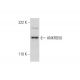 ANKRD50 Antibody (E-12) - Western Blotting - Image 300155