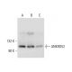 ANKRD52 Antibody (A-1) - Western Blotting - Image 305758 