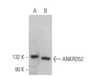 ANKRD52 Antibody (A-1) - Western Blotting - Image 372103 