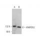 ANKRD52 Antibody (A-1) - Western Blotting - Image 372103 