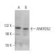 ANKRD52 Antibody (A-1) - Western Blotting - Image 372105