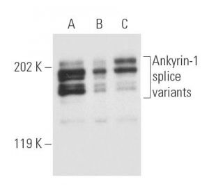 Ankyrin-1 Antibody (8C3) - Western Blotting - Image 5567 
