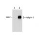 Ankyrin-1 Antibody (8C3) - Western Blotting - Image 159315