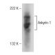 Ankyrin-1 Antibody (D-3) - Western Blotting - Image 148740