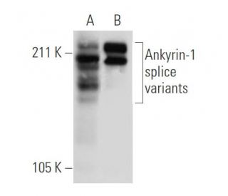 Ankyrin-1 Antibody (D-3) - Western Blotting - Image 294445 