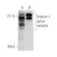 Ankyrin-1 Antibody (D-3) - Western Blotting - Image 294445 