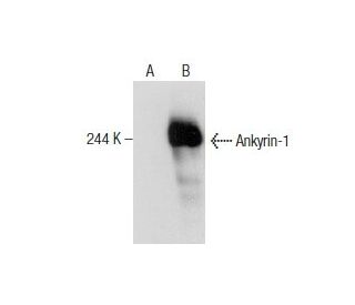 Ankyrin-1 Antibody (H-4) - Western Blotting - Image 159313 