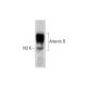 Ankyrin B Antibody (G-11) - Western Blotting - Image 144801