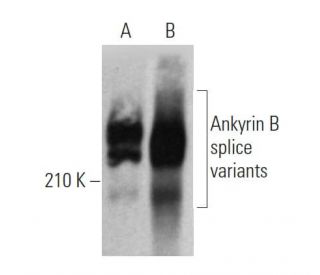 Ankyrin B Antibody (G-11) - Western Blotting - Image 358595 