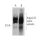 Ankyrin B Antibody (G-11) - Western Blotting - Image 358595 
