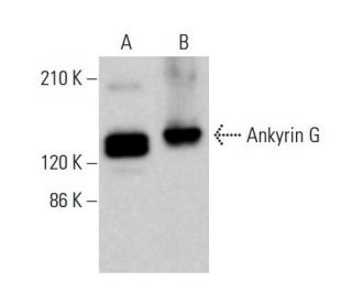 Ankyrin G Antibody (H-4) - Western Blotting - Image 377227 