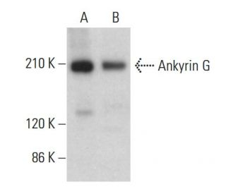 Ankyrin G Antibody (H-4) - Western Blotting - Image 377223 