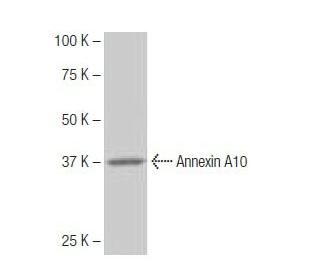 Annexin A10 Antibody (5-RE28) - Western Blotting - Image 64844