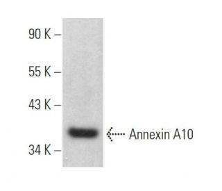 Annexin A10 Antibody (E-11) - Western Blotting - Image 369376 