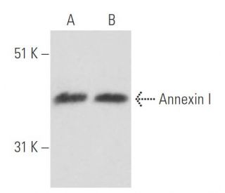 Annexin I Antibody (74/3) - Western Blotting - Image 17193 
