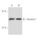 Annexin I Antibody (74/3) - Western Blotting - Image 17193 