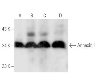 Annexin I Antibody (ANEX 5E4/1) - Western Blotting - Image 14330 