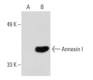 Annexin I Antibody (ANEX 6E4/3) - Western Blotting - Image 20211 